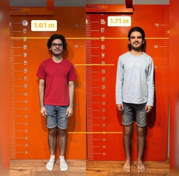 Height increase result 3